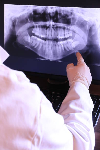 Best Emergency Dental Care for Abscessed Tooth in Seven Points, TX