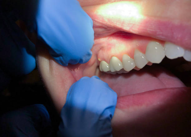 Best Mobile Emergency Dentist in Seven Points, TX